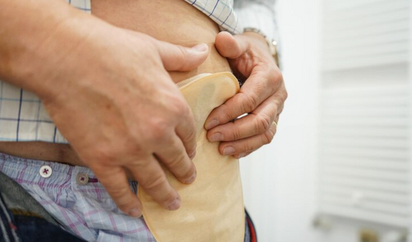 7 Reasons Your Ostomy Wafer Keeps Leaking (and How to Fix Each)