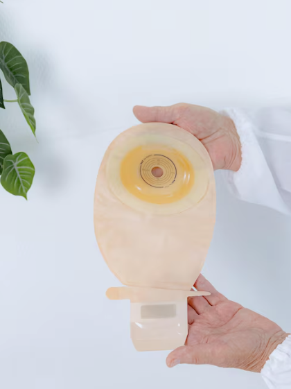 What Is an Ostomy Barrier Ring? Hollister CeraRing Explained