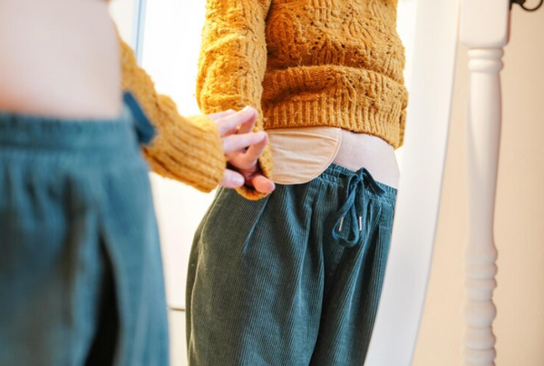 How to Stop Peristomal Skin Irritation: 6 Steps That Actually Work